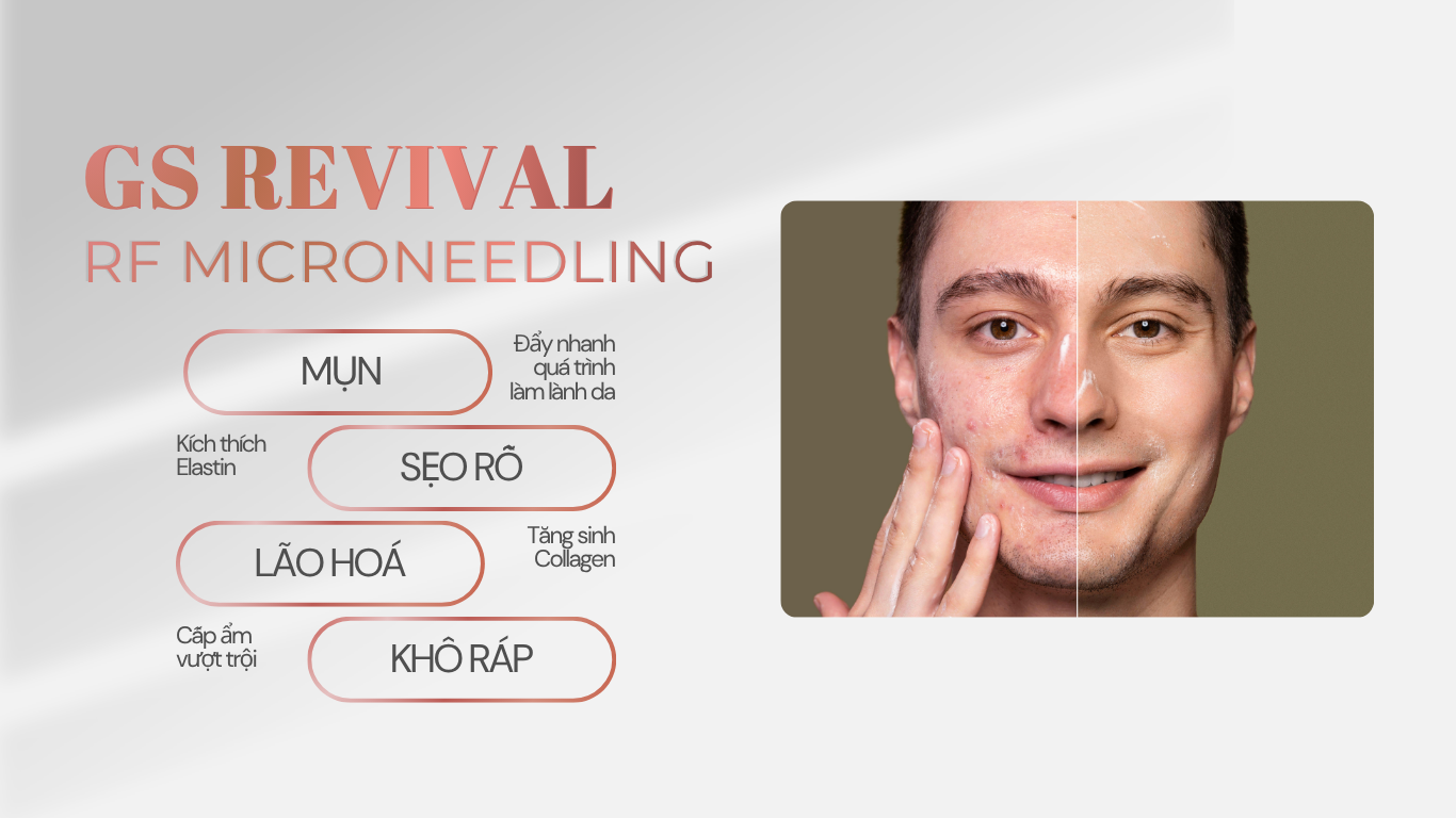 Liệu trình vi kim kết hợp sóng siêu âm RF Microneedling tại GS Medi quận 1 và quận 2
