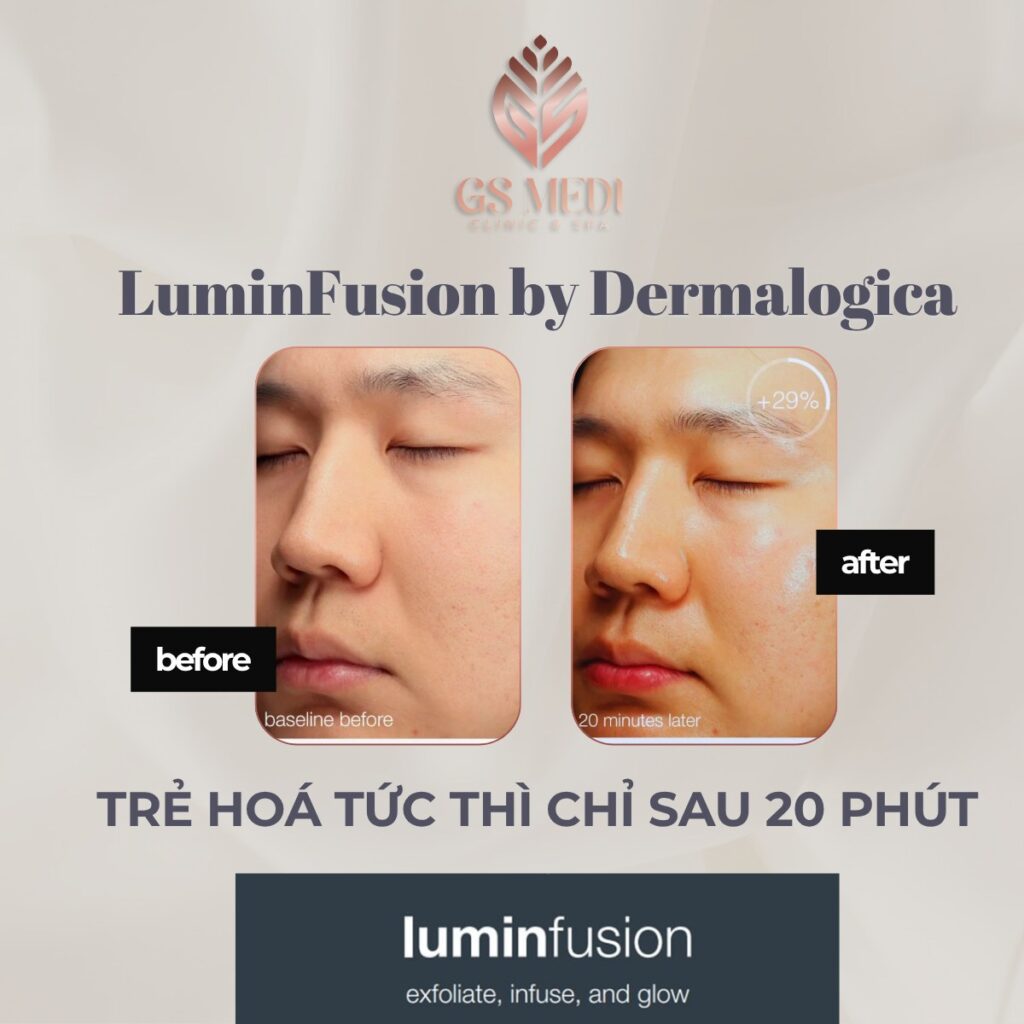 Liệu trình trẻ hoá Dermalogica luminfusion