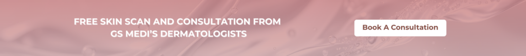Free Consultation from dermalogist at GS Medi