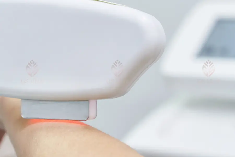 liệu trình triệt lông tại GS Medi Clinic - Spa