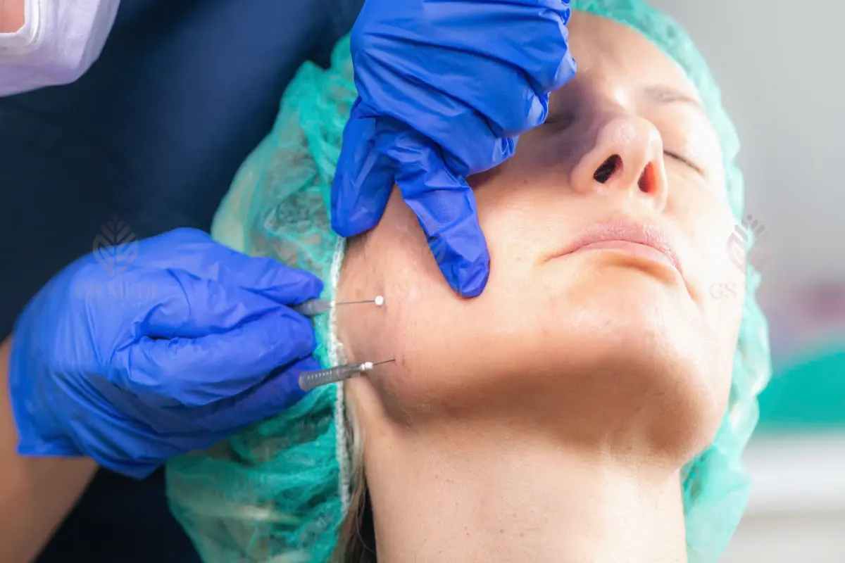 Chỉ Collagen Là Gì